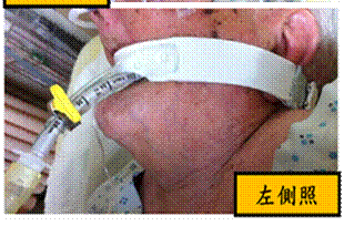 左側