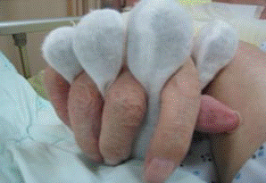 手套2